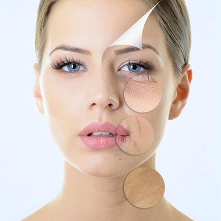 Impurezas da pel facial indicacións para tratamentos anti-envellecemento